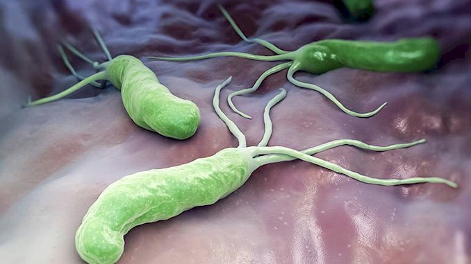 幽門螺旋桿菌（H. pylori）感染-症狀、診斷、治療和預防